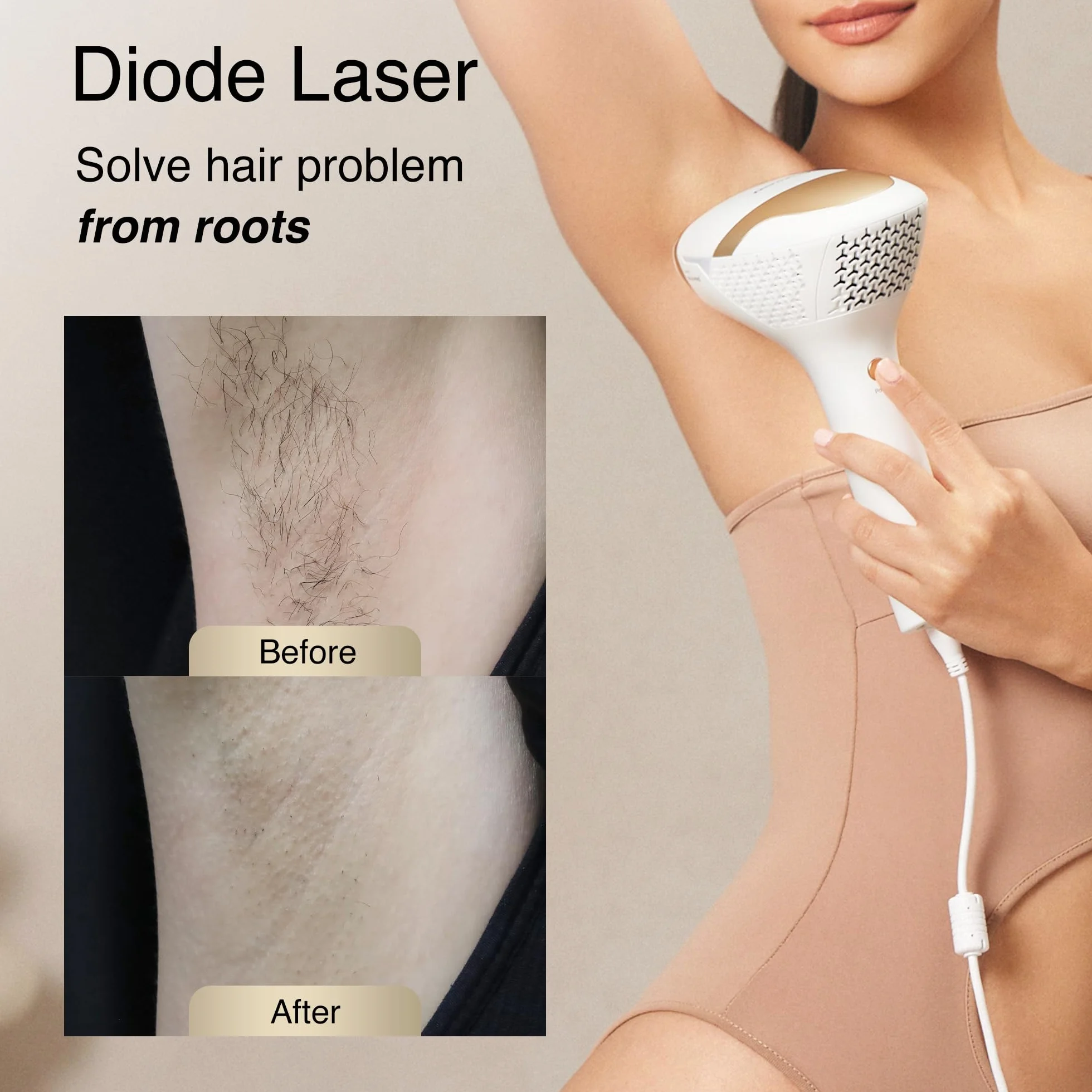 DermRays V4S 810nm Diodenlaser Haarentfernung für 1-5 Teint