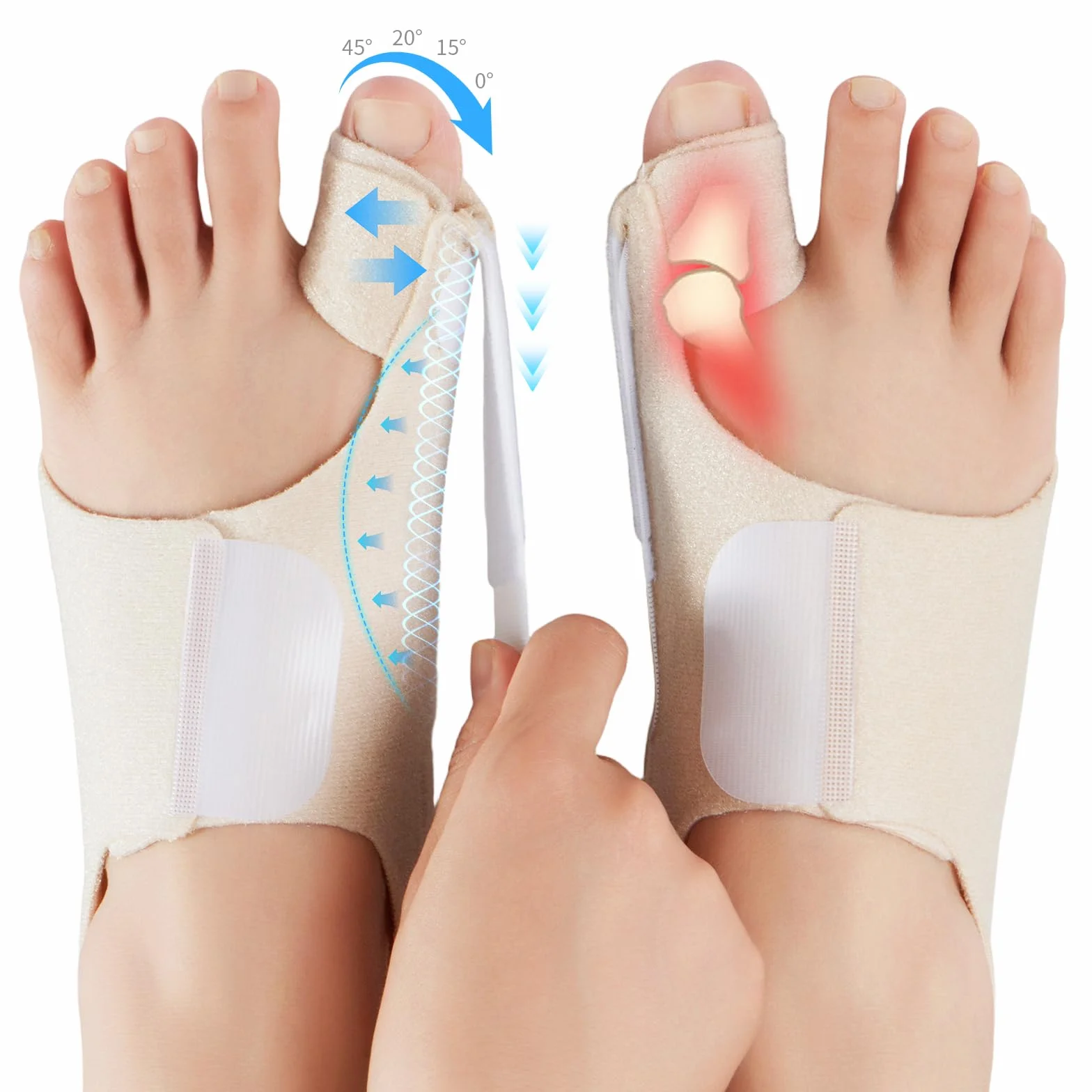 Hallux Valgus Schiene für Damen & Herren – Verstellbare Hallux Valgus Bandage mit Gelpolster zur Korrektur und Schmerzlinderung – Einheitsgröße, 1 Paar