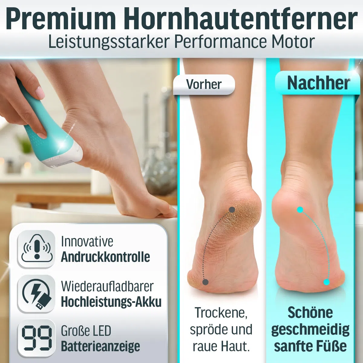 Grundig Hornhautentferner elektrisch Pro - schnell Hornhaut entfernen ohne Bücken - Premium Akku Hornhaut Entferner nass + trocken mit Arbeitslicht, 3 Fuß Rollen, wiederaufladbar (Gerät)