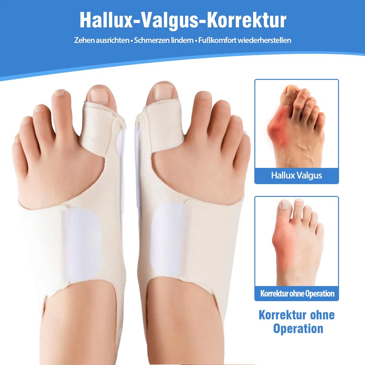 Hallux Valgus Schiene für Damen & Herren – Verstellbare Hallux Valgus Bandage mit Gelpolster zur Korrektur und Schmerzlinderung – Einheitsgröße, 1 Paar