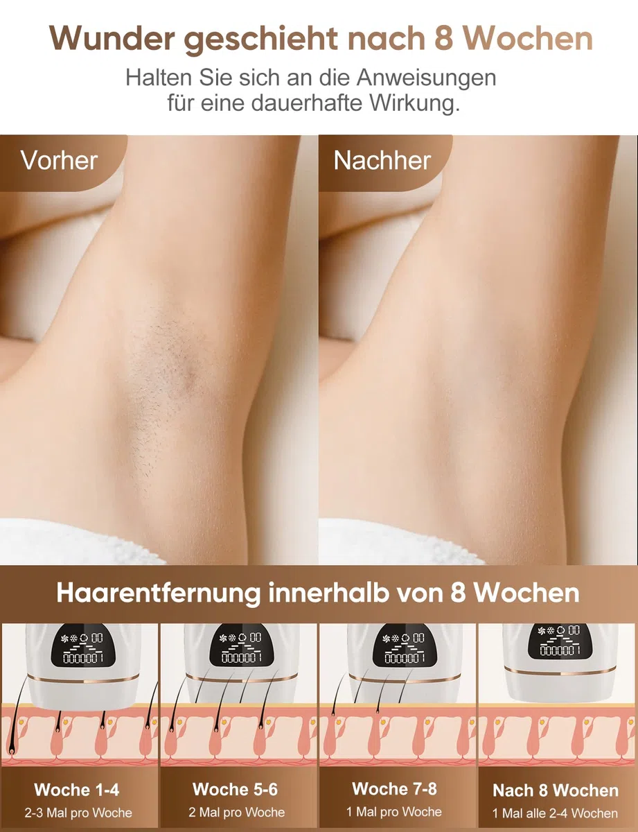 IPL Geräte Haarentfernung Laser Mit Gefrierfunktion 9 Energiestufen 1000,000 Lichtimpulse Dauerhafte Schmerzlose Haarentfernung für Männer Frauen Gesicht Achseln Beine Körper