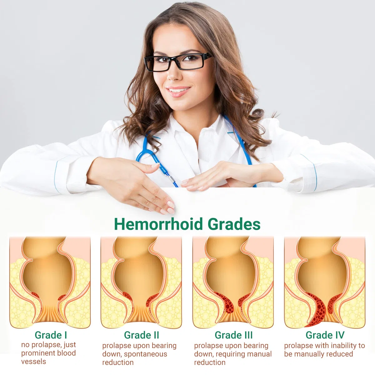 Hämorrhoiden-Creme zur Behandlung von Schmerzen, Juckreiz, Brennen, Schwellung, Rissen und Blutungen – Starke Wirkung bei inneren und äußeren Hämorrhoiden (2-Pack)