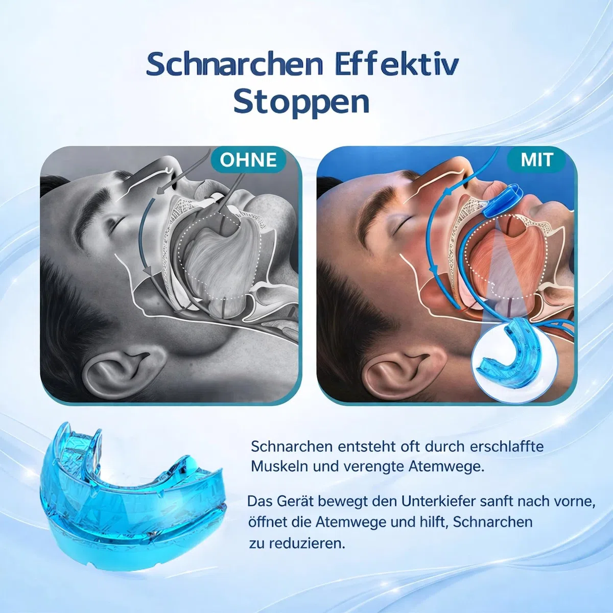Schnarchstopper Anti Schnarch, Schnarchschiene gegen Schnarchen, Reduziert Zähneknirschen, Verbessert den Schlaf für Männer und Frauen (Blau)