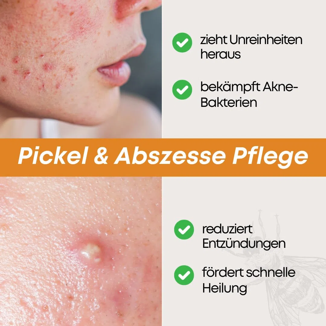 Zugsalbe & Wundsalbe 60g | Wund und Heilsalbe mit Calendula | Mighty Propolis Salbe | Wundheilsalbe | Salbe Gegen Juckreiz | Bee Enriched