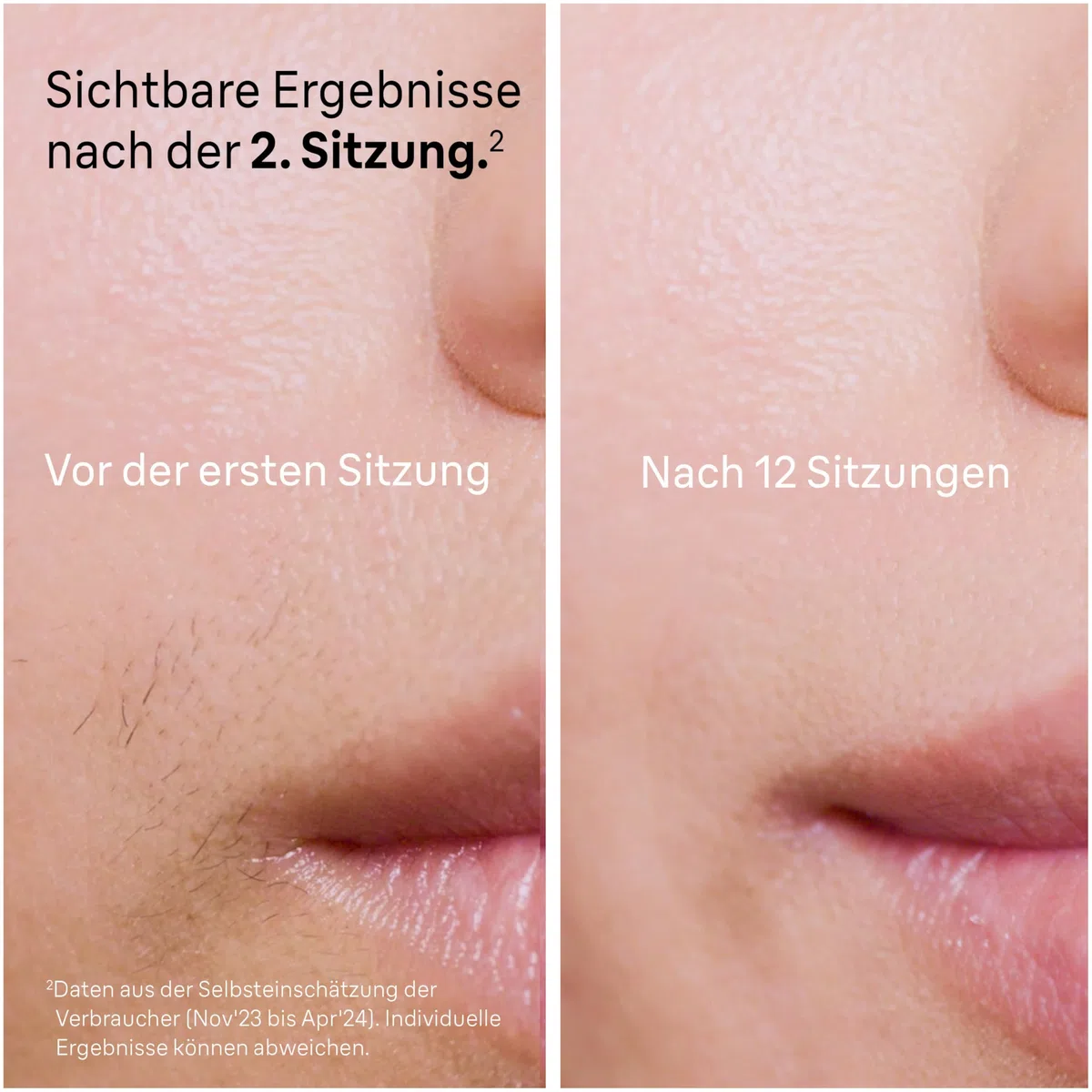 Braun Silk·expert Pro 5 PL5358 IPL Haarentfernung Weiß/Gold Dauerhafte Haarentfernung für Zuhause