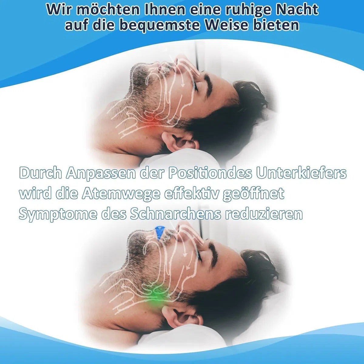 Schnarchstopper, Ergonomisch Schnarchschiene für Männer und Frauen, Effektiv Anti Schnarch Schiene Snoring Stopper, Kein BPA, Extra Weich, Gebrauchsfertig für Schnarchfreien Schlaf Nacht