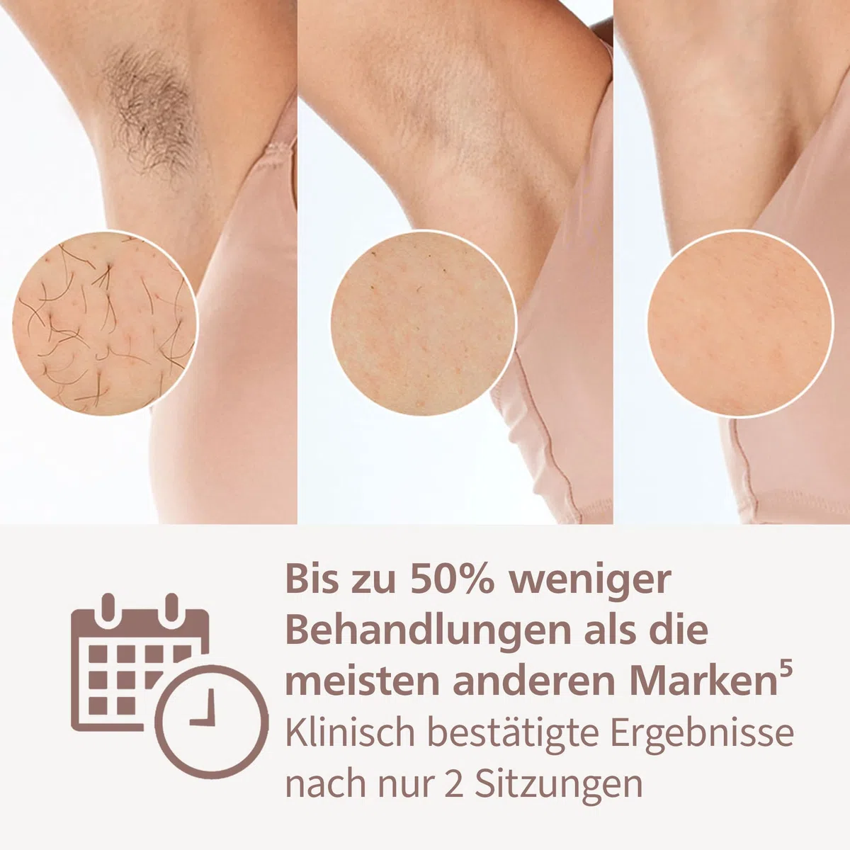 Philips Lumea IPL 9900 Series Haarentfernungsgerät kabellos mit 4 Aufsätzen BRI951/00