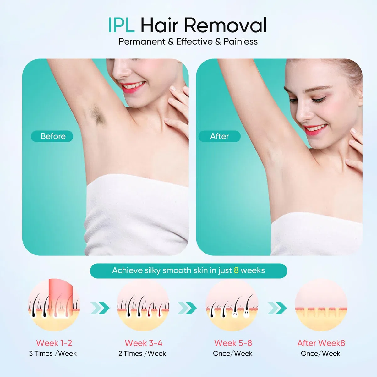 IPL Laser Hair Removal Device, Laser Haarentfernungsgerät mit Kühlfunktion, 5 Energiestufen,999,999 Light Pulses, Haarentfernung Laser für Frauen Männer Women Gesicht Bikinizone Arme Beine Körper