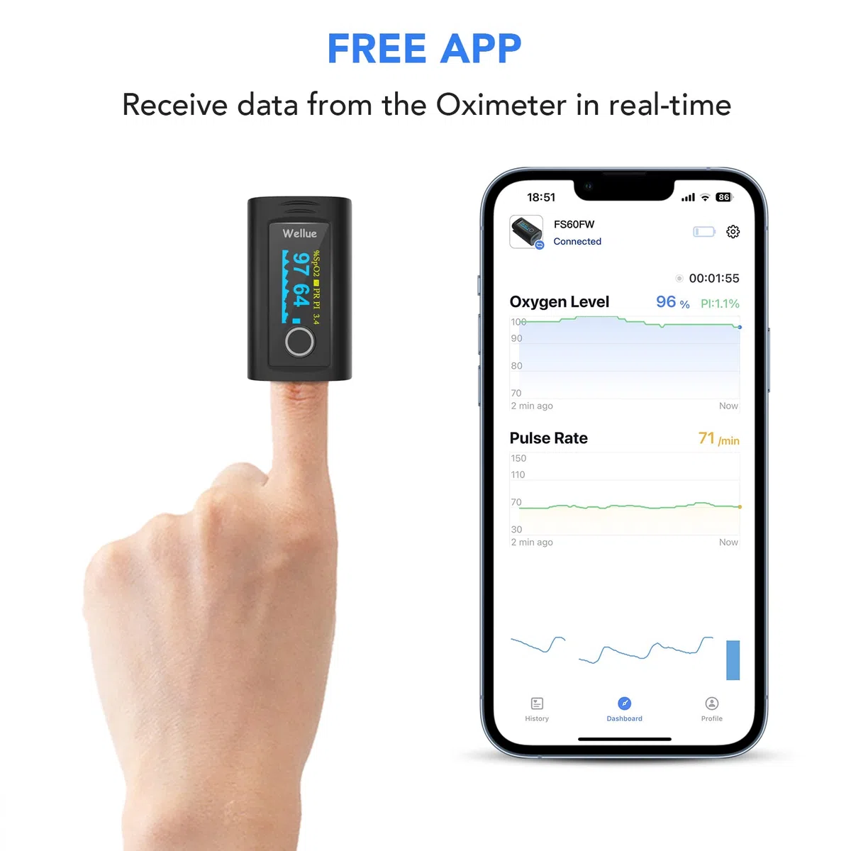 ViATOM Pulsoximeter mit Bluetooth und Offline-Speicher,Sauerstoffsättigung Messgerät Finger,Blutsauerstoffmessgerät Finger für Sp-O2 und Herzfrequenzmesser, inklusive Batterien und Umhängeband