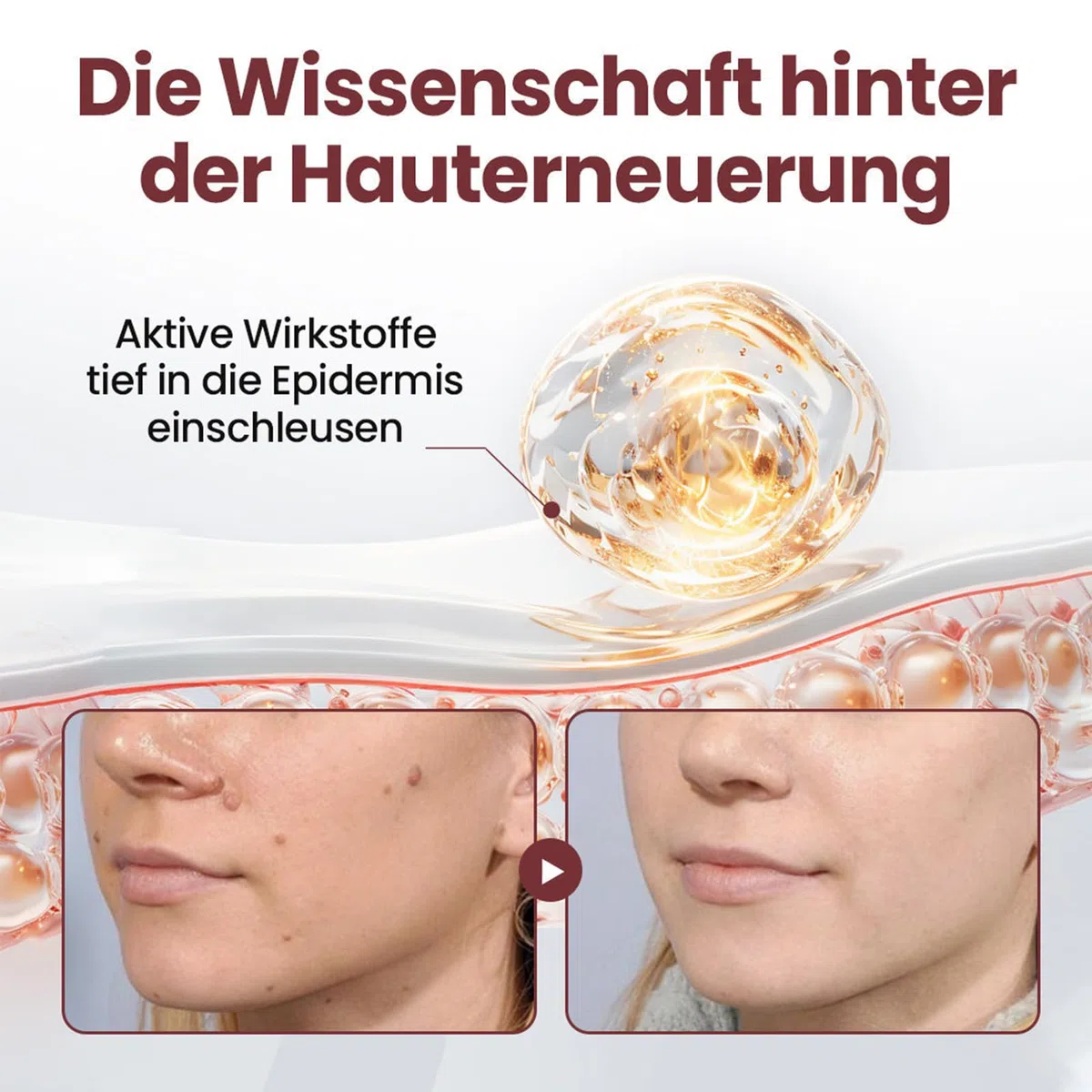 Biancat KeraErase Dual-Action Erneuerungscreme, Biancat Warzen und Hautwucherungen Entfernen Creme, Natürlich KeraErase Hautreparaturcreme, für Aller Hauttypen (1 Stück)