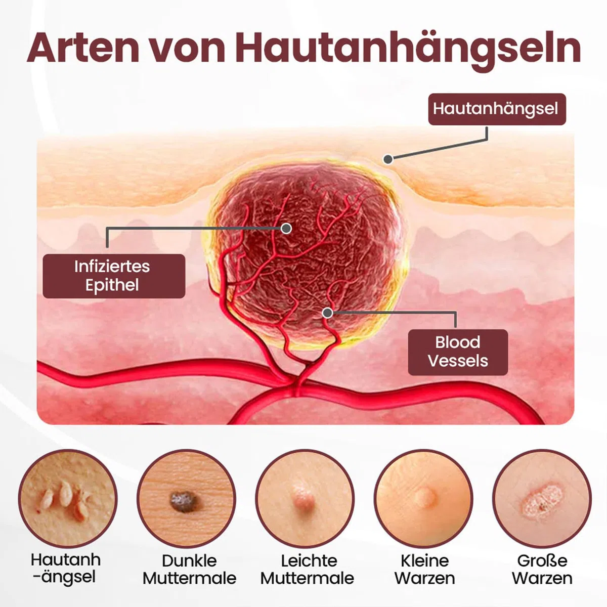 Biancat KeraErase Dual-Action Erneuerungscreme, Biancat Warzen und Hautwucherungen Entfernen Creme, Natürlich KeraErase Hautreparaturcreme, für Aller Hauttypen (1 Stück)