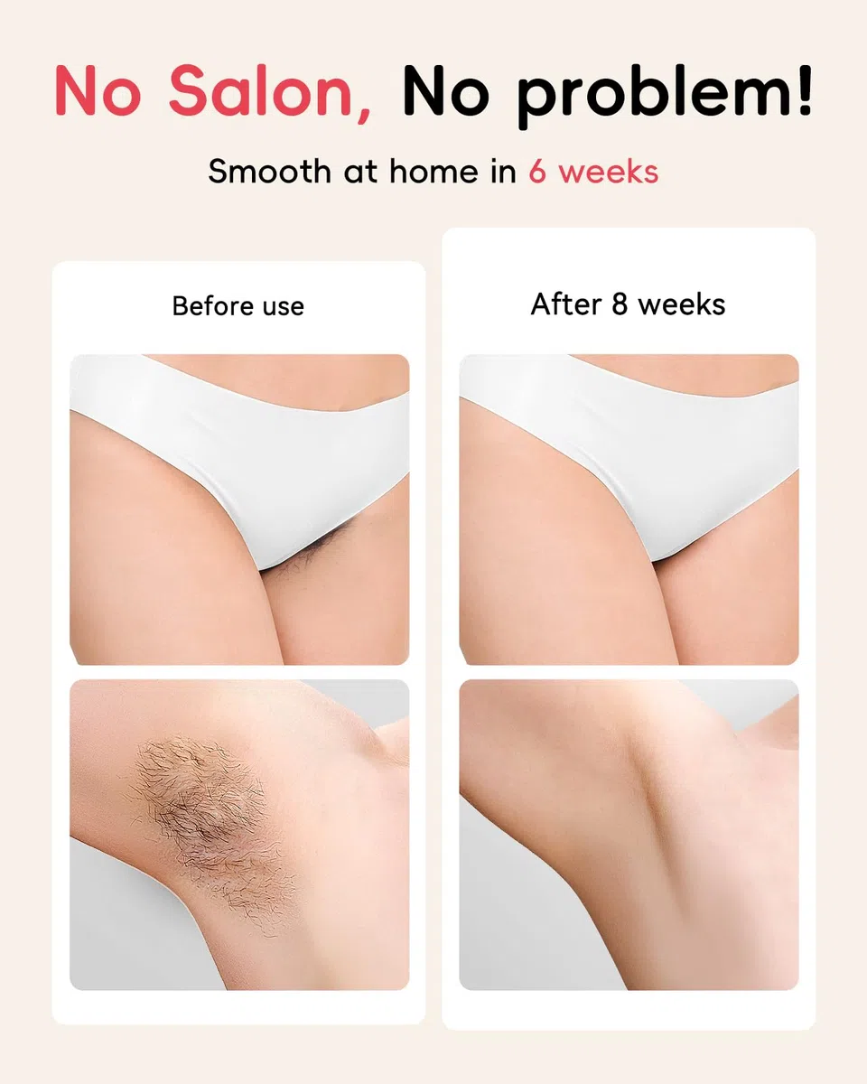 Haarlosy IPL Geräte Haarentfernung - 22J Schmerzfreie Laser Haarentfernungsgerät Ideal für Zuhause, Geeignet für Damen Herren am Körper, Gesicht, Achseln, Beinen