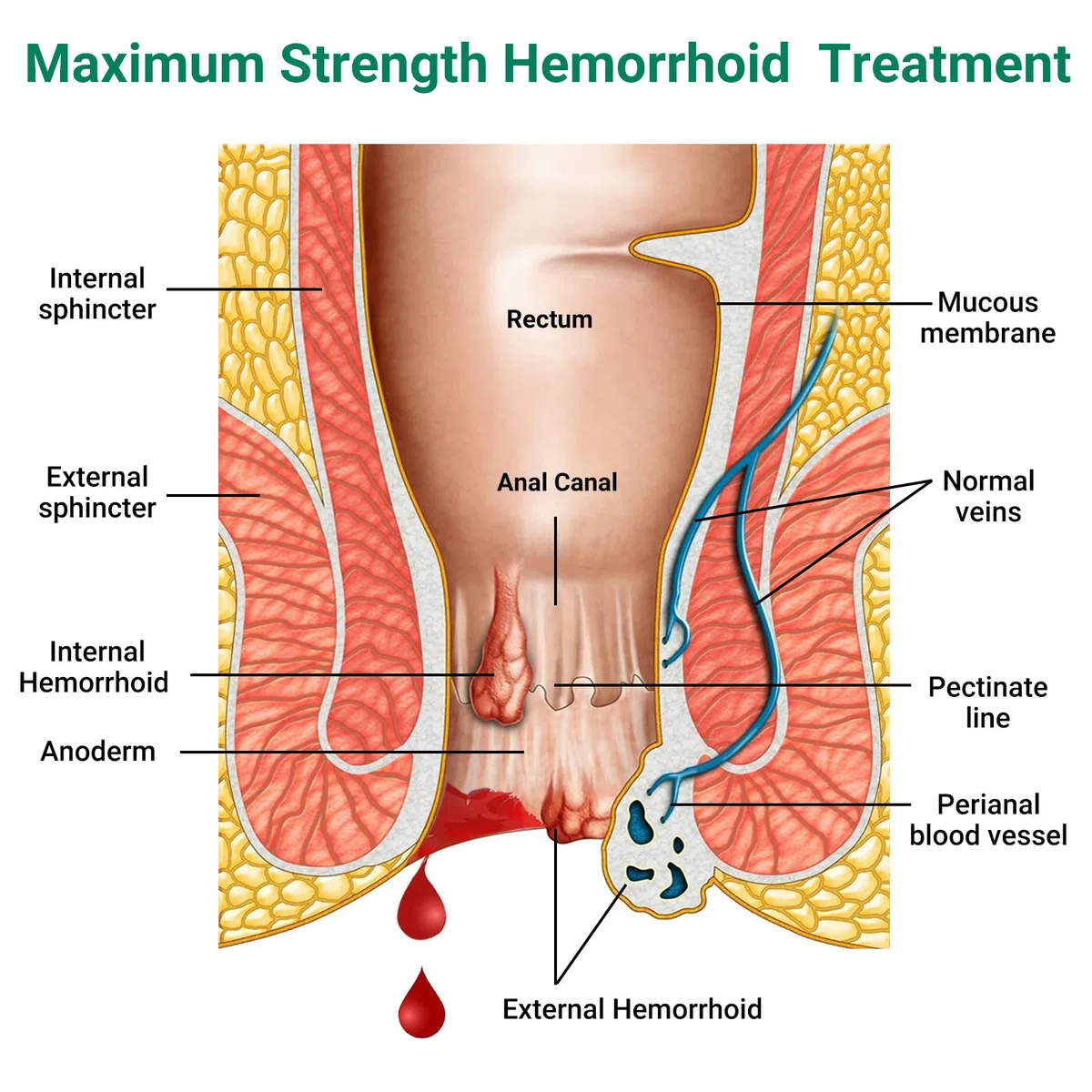 Hämorrhoiden-Creme zur Behandlung von Schmerzen, Juckreiz, Brennen, Schwellung, Rissen und Blutungen – Starke Wirkung bei inneren und äußeren Hämorrhoiden (2-Pack)