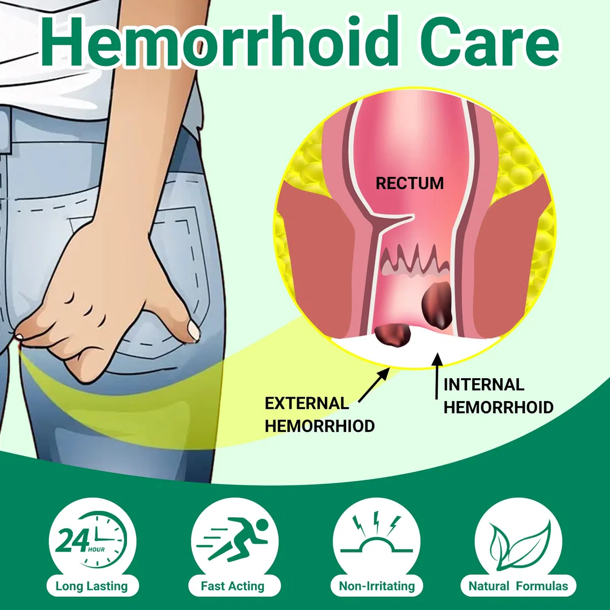 Hämorrhoiden-Creme zur Behandlung von Schmerzen, Juckreiz, Brennen, Schwellung, Rissen und Blutungen – Starke Wirkung bei inneren und äußeren Hämorrhoiden (2-Pack)