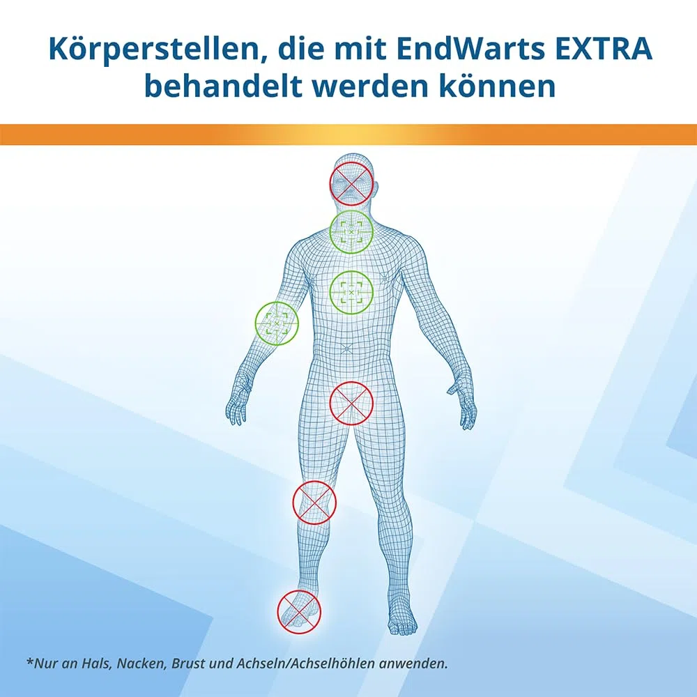 EndWarts EXTRA: Stielwarzen behandeln, Vereisungsmittel zur Behandlung von Stielwarzen an Hals, Brust & Achseln, 9-Einweg-Spitzen & 9 Pflaster, Aufnäher,Spray